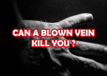 Can A Blown Vein Kill You