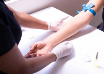 How Long Can a Tourniquet Be Left On